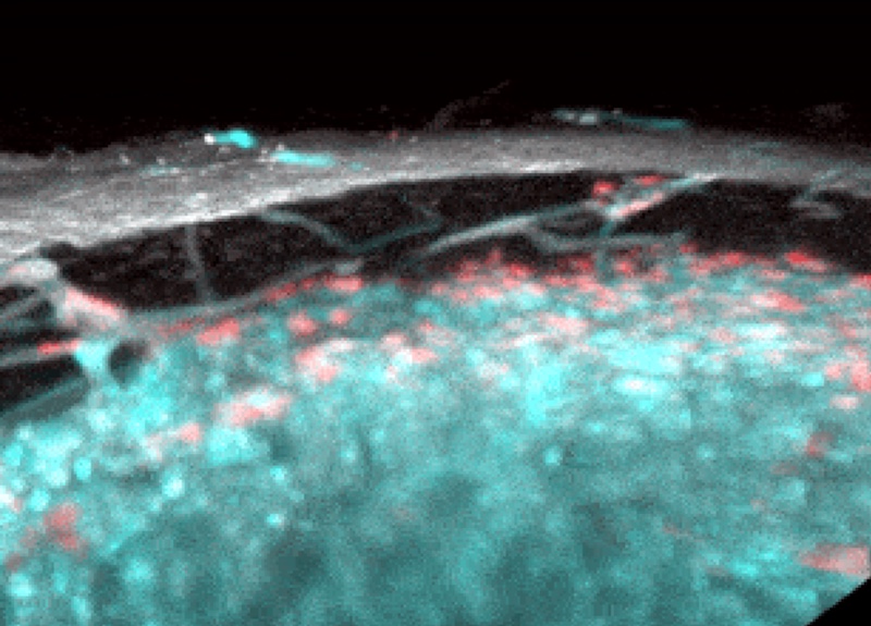 Científicos descubren vasos sanguíneos ocultos en los huesos [VIDEO]